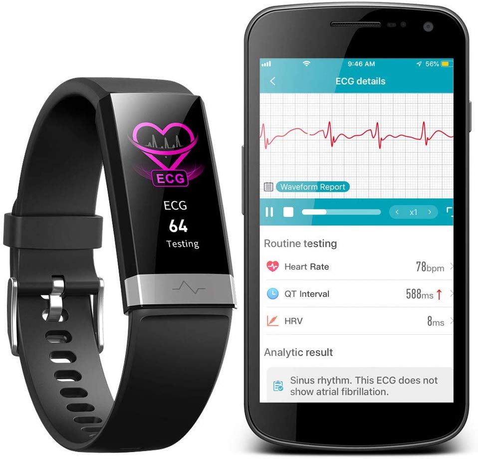 AUPALLA Activity Tracker With ECG Monitor Measure Blood Oxygen Monitor