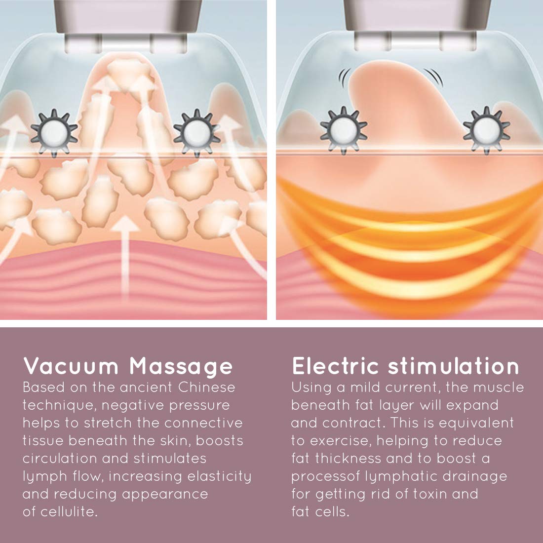 HoMedics Beauty Anti Cellulite Vacuum Massage Skin Smoother, Suction to Detox Skin, Reduce Orange Peel, Fluid Retention - Image 3